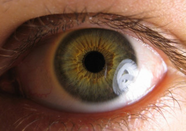 Ojo 2
