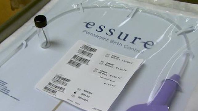 Essureanticonceptivo 01082018