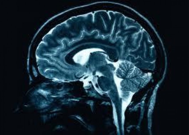Cerebro 24547 1