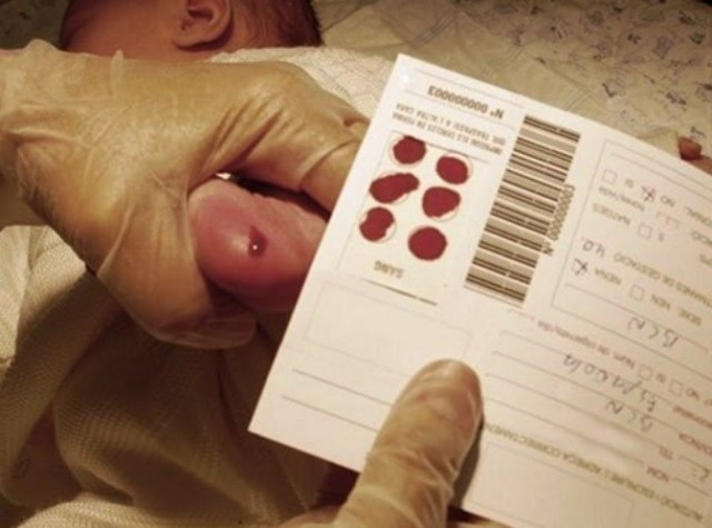 Prueba del taln de cribado neonatal en un beb