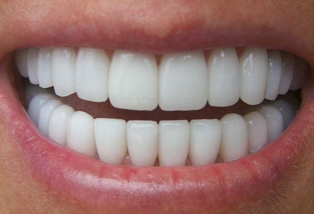 Dentaduraimagen
