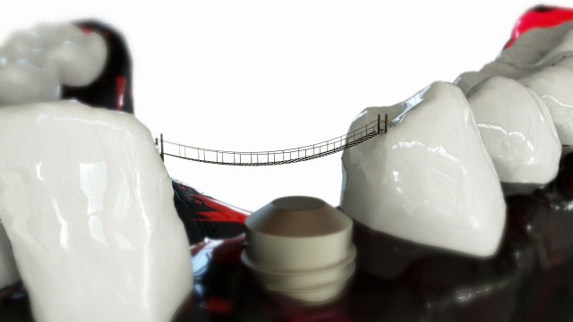 EuropaPress 3252322 desarrolla estructura 3d base titanio mejora implantes oseos