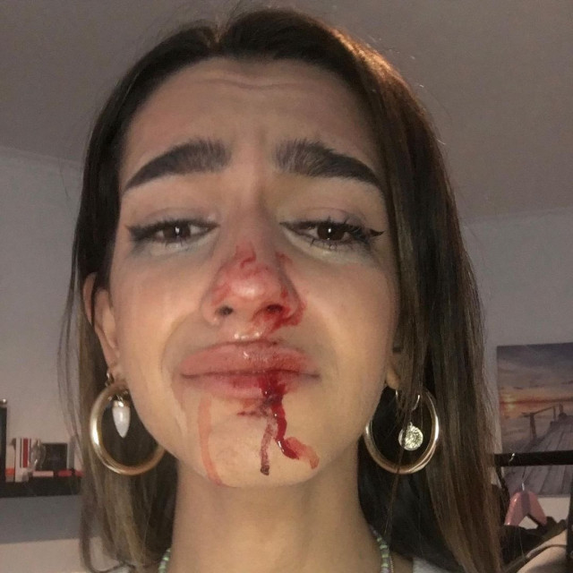 Transexualagredidabarcelona