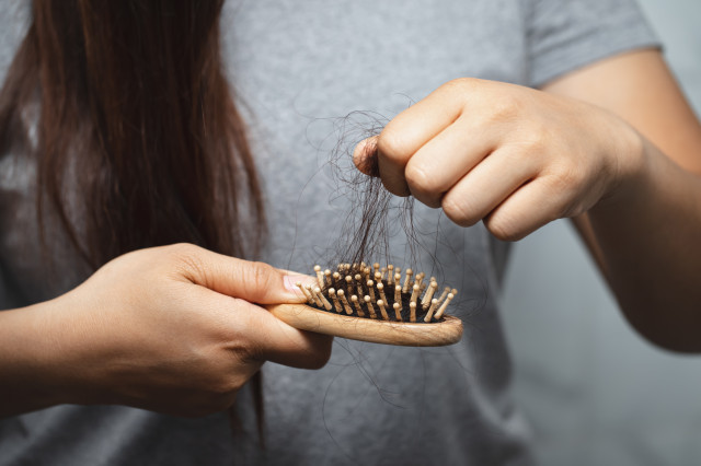WomenhavehairlossproblemsNTHMY4L