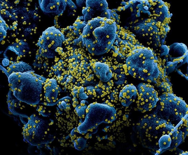EuropaPress 3321760 micrografia electronica barrido coloreada celula apoptotica azul muy