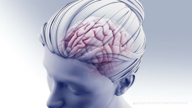 Pot l'estimulació cerebral personalitzada tractar la depressió?