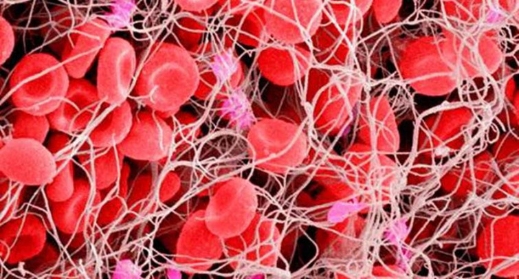 Descobreixen com millorar l'heparina, l'anticoagulant que causa els mateixos trombes que AstraZeneca