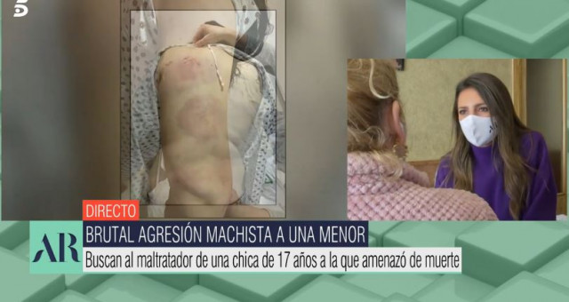 Agresion
