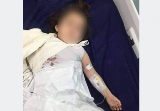Un ós arrenca el braç a una nena de tres anys a un Zoo