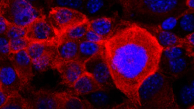 Revelen el camí que segueixen les cèl·lules canceroses metastàsiques