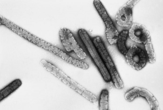 Exteriors actualitza les seves recomanacions per a Guinea Equatorial després del brot del virus de Marburg