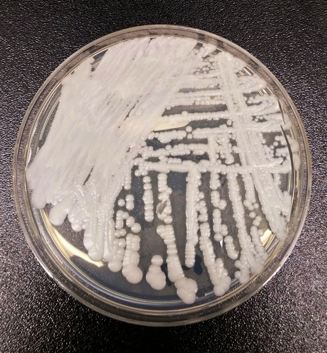 Candidaauris 2016250px