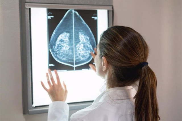 Sanitat donarà el sí a finançar medicaments per tractar el càncer de mama metastàtic