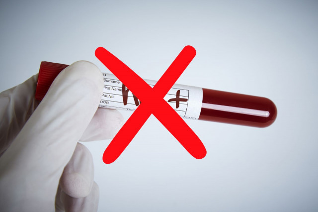 Descobreixen que 5 menors poden controlar el VIH sense tractament antiretroviral