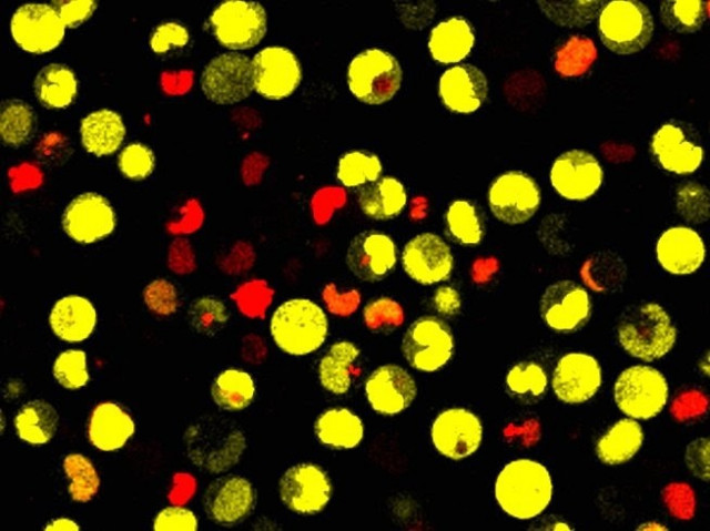 Quan els músculs s'exerciten ajuden les neurones a créixer, segons un nou estudi