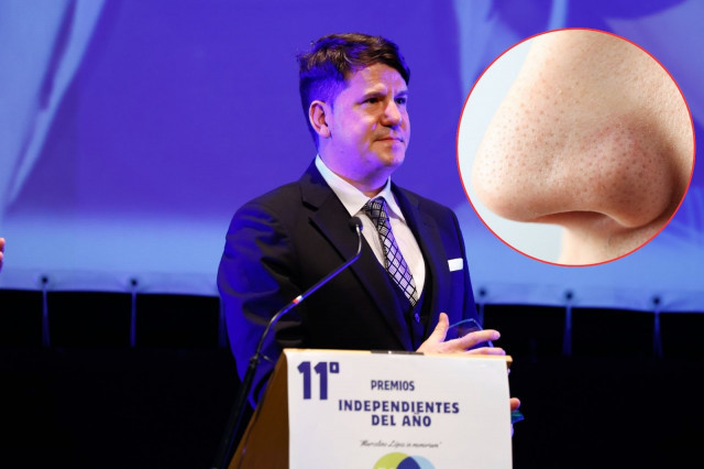 Lucas González reapareix amb un nas diferent i reviu els rumors de cirurgia estètica