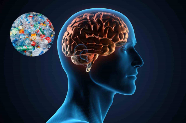 La presència de microplàstics al cervell humà es dispara un 50% en els últims 8 anys