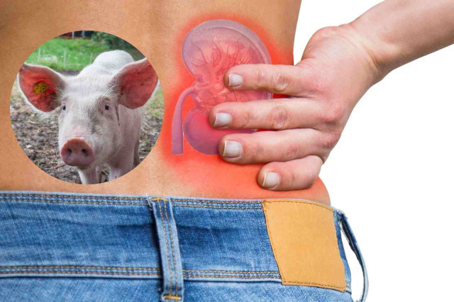 Estats Units aprova assaigs clínics per a trasplantaments de ronyó de porc en humans