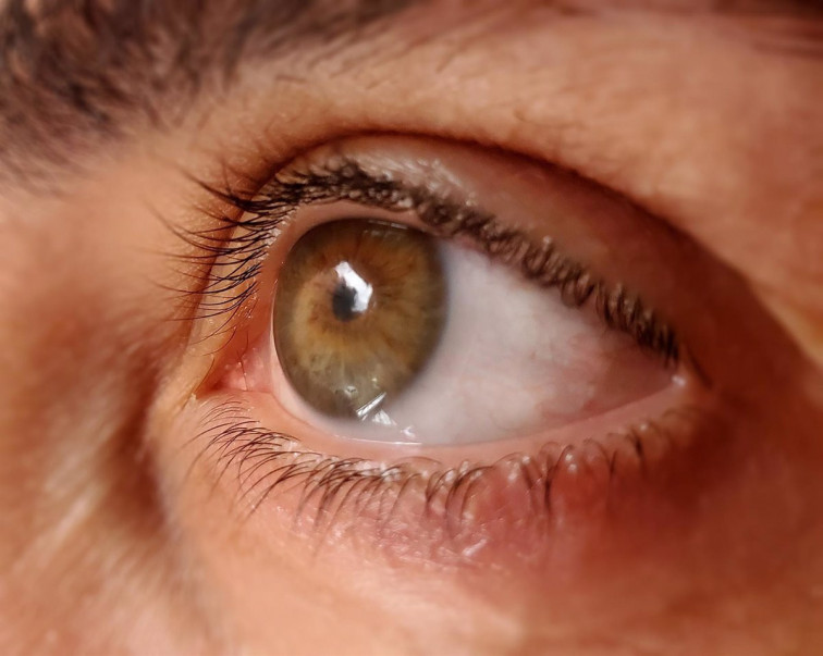 El glaucoma és la principal causa de ceguesa irreversible en el món