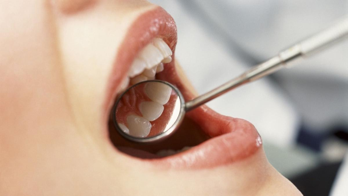 Catalunyapress dents