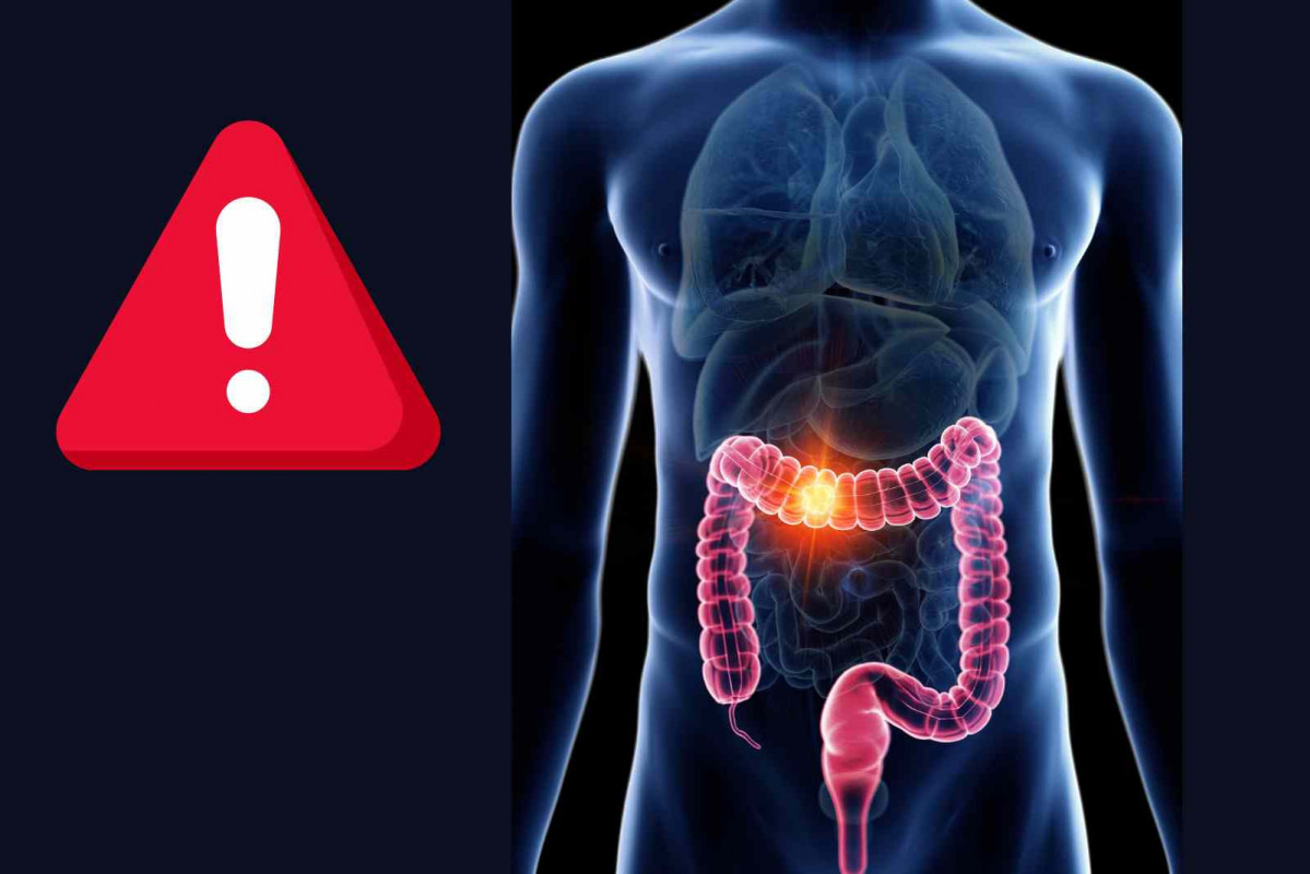 Cáncer