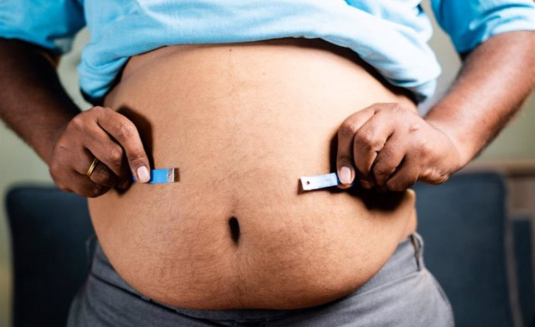 Un altre risc de l'obesitat greu: això és el que ha descobert una recerca de científics catalans