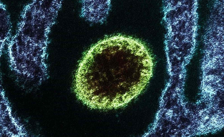 Alarma mundial: Mor una jove pel virus Nipah i creixen els temors d'una nova pandèmia
