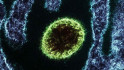 Alarma mundial: Mor una jove pel virus Nipah i creixen els temors d'una nova pandèmia