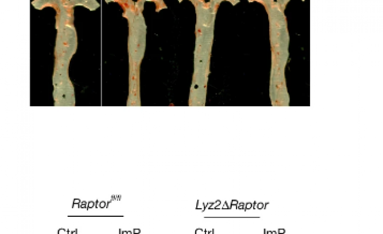 Descobreixen un metabòlit intestinal clau en l'origen de l'aterosclerosi