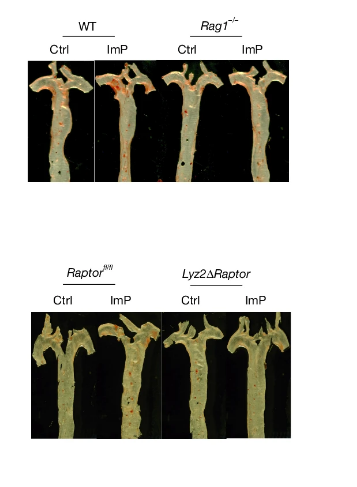 Descobreixen un metabòlit intestinal clau en l'origen de l'aterosclerosi