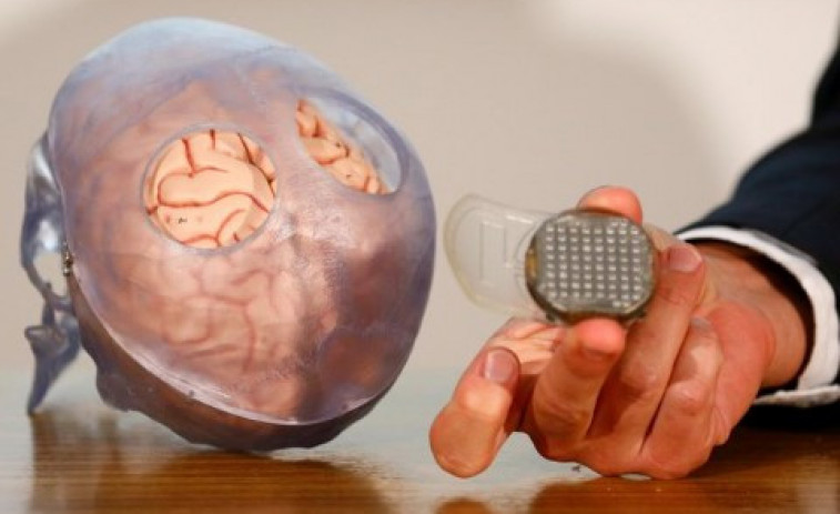 Una fita de Stanford amb dues cares: l'implant cerebral que ens acosta a la telepatia