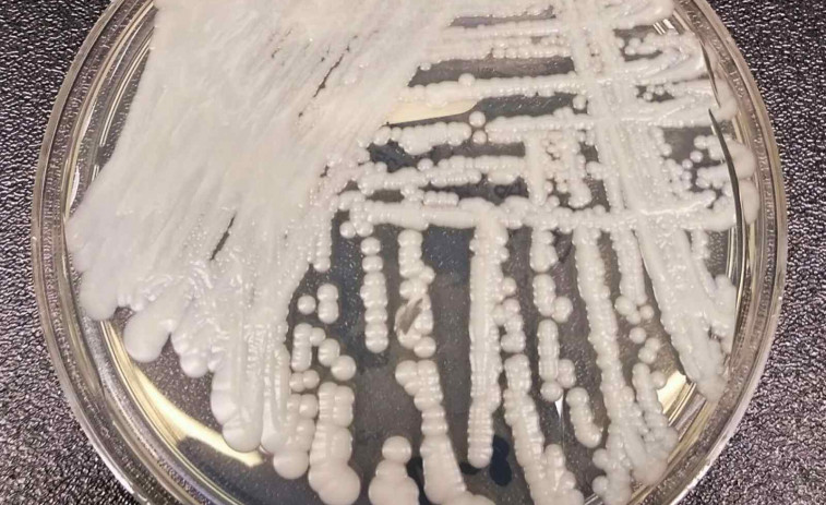 Alarma sanitària: un fong letal s'està propagant pels hospitals d'Espanya