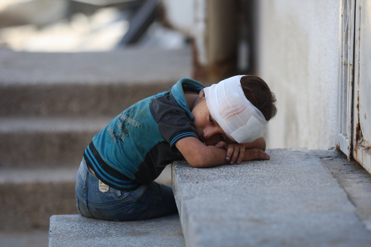 EuropaPress 6958480 16 september 2025 palestinian territories gaza an injured palestinian boy