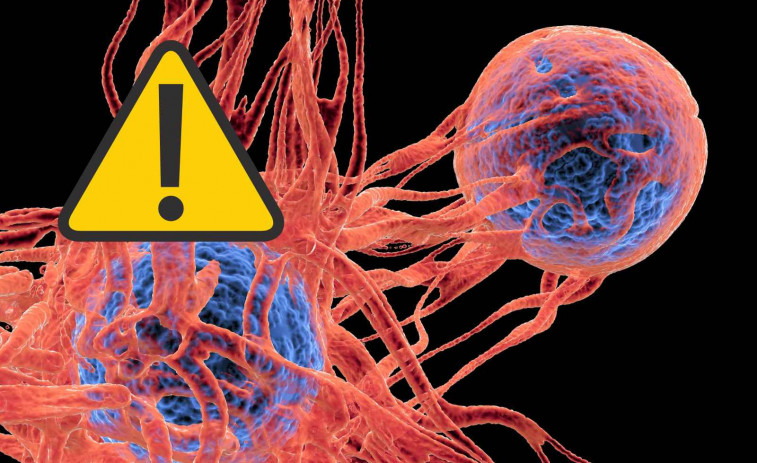 Els casos de càncer colorectal s'estan disparant entre els joves: Què està passant?