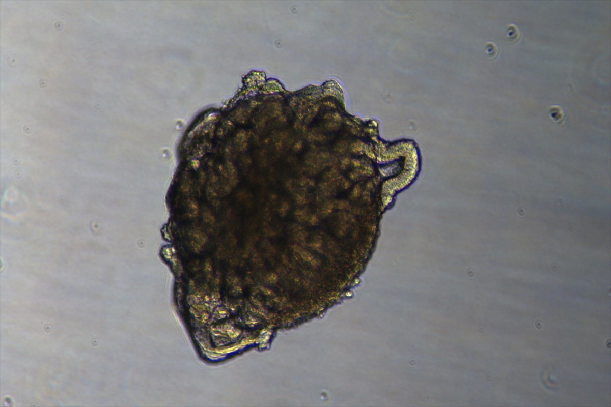 EuropaPress 7069897 imagen organoides