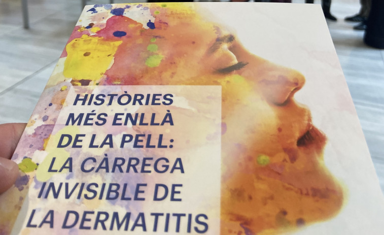 Ment i pell connectades: experts i afectats trenquen el silenci sobre la dermatitis atòpica