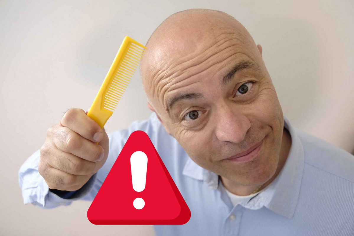 Alerta, calvo   CANVA