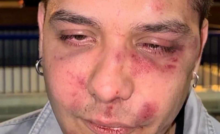 VÍDEO | Un jove denúncia que ha rebut una brutal pallissa a Màlaga: “Tu ets antifeixista, veritat?”