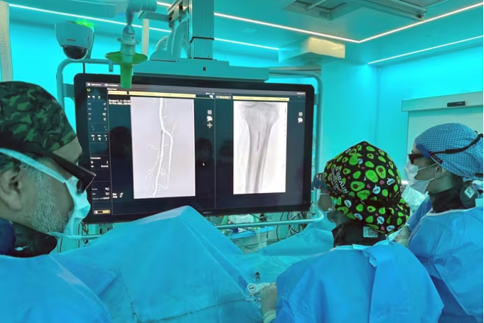 L'Hospital Trueta de Girona lidera un avanç mèdic a Catalunya per a evitar l'amputació d'extremitats