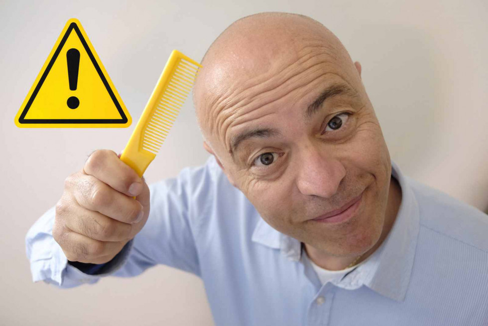 Alerta, calvicie   CANVA