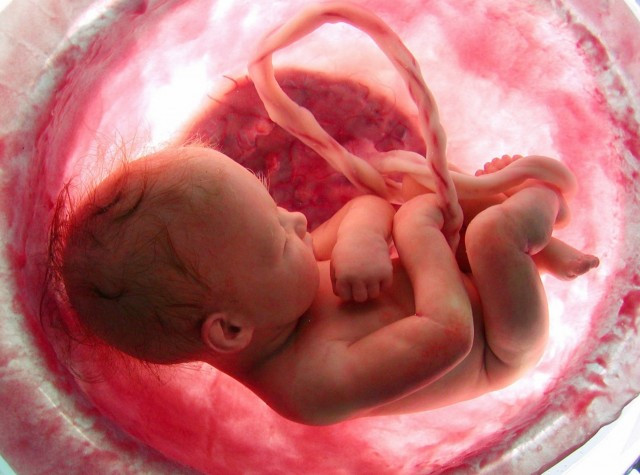 La sang del cordó umbilical es converteix en el millor tractament de malalties autoimmunes