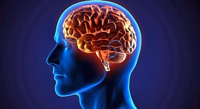 Cerebro 1