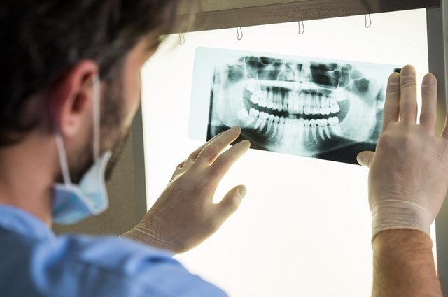 Acromegàlia dentista gigantisme