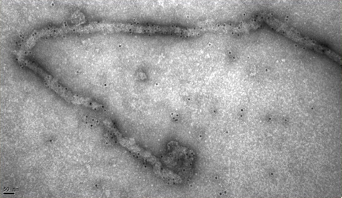 Virus ebola CSIC