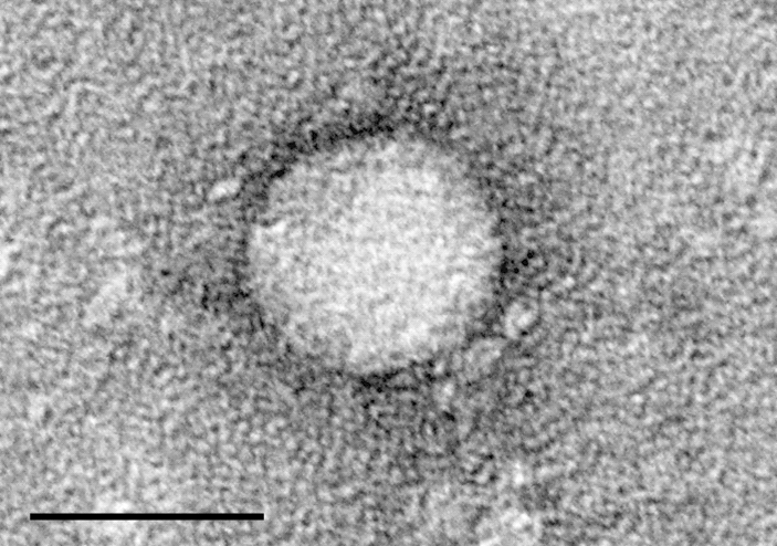 Virus hepatitis c