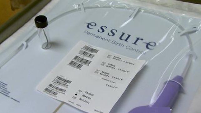 Essure anticonceptiu 01082018