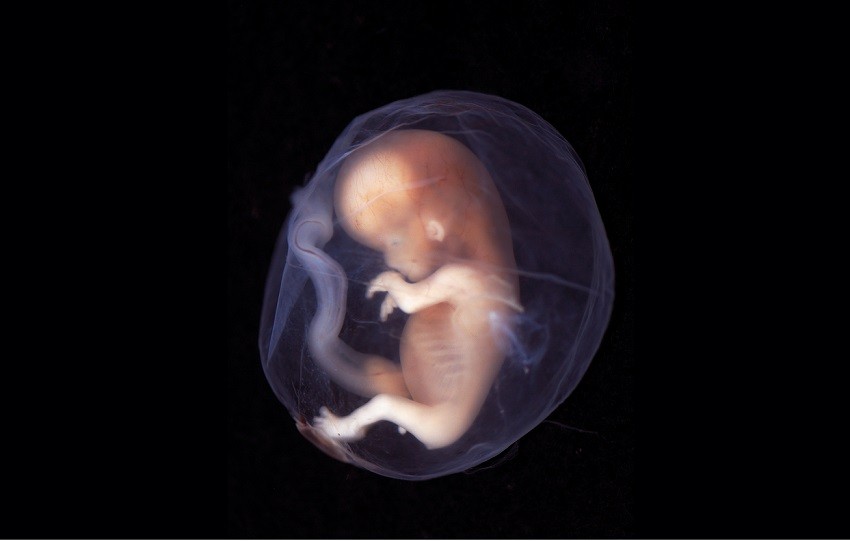 fetus