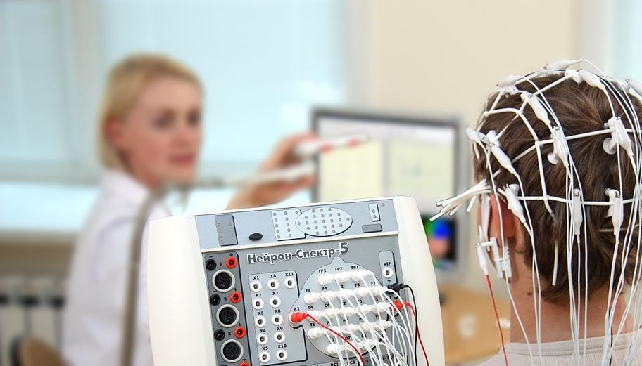 electroencefalograma