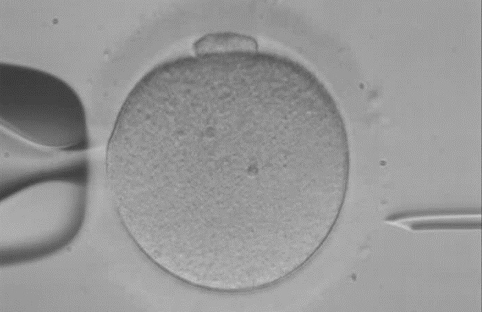 Fertilizaciu00f3n in vitro