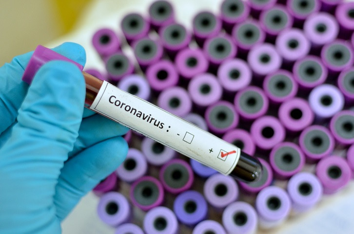 Coronavirus positive Blood sample with respiratory coronavirus positive